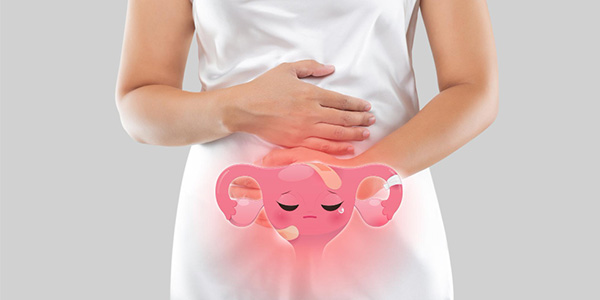Benefits of Early Endometriosis Treatment
